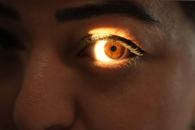 Tiroid hastalıkları göz sağlığını tehdit ediyor! - Resim: 1