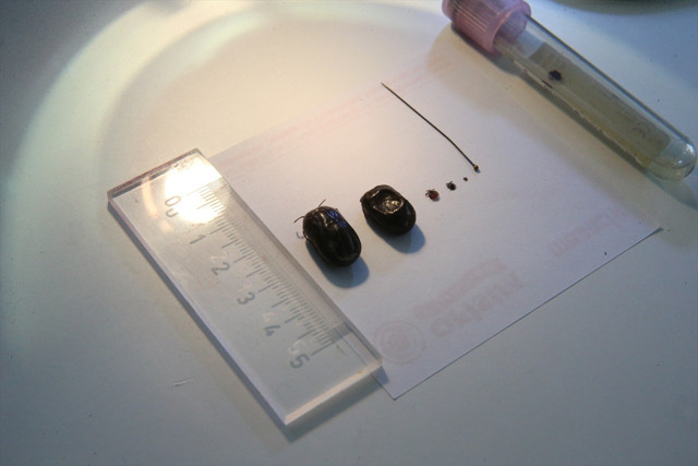 Toplu iğne başı kadar küçük kenelere dikkat! Havalar ısındı, vakalar arttı - Resim: 1