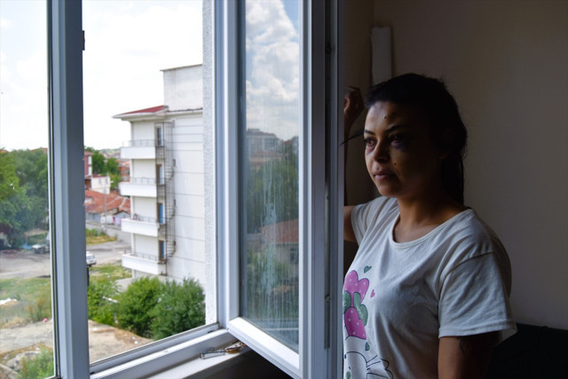 Pencereden düğünü izlerken dehşeti yaşadı! Tüfekten çıkan saçmalar genç kadına isabet etti - Resim: 0