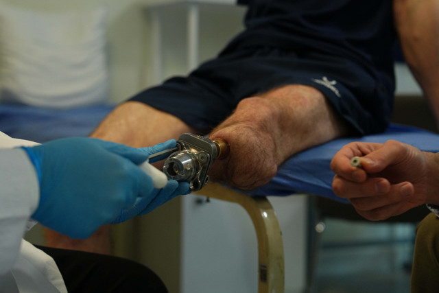 Bu yöntem amputasyon hastalarına umut oldu - Resim: 2