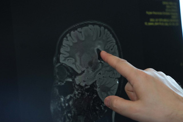 Yürüme güçlüğü olan çocuklara umut - Resim: 1