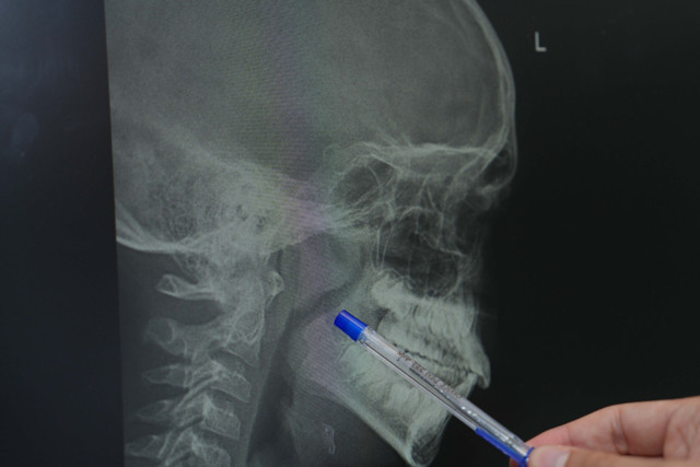 Bu şekilde horluyorsa dikkat! Çocuklarda horlama bakın neyin belirtisi - Resim: 0