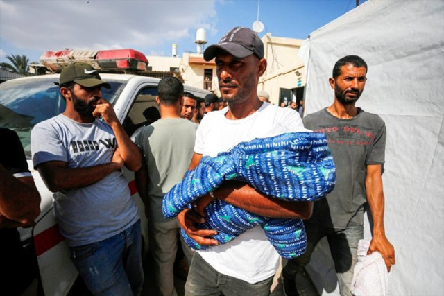 Açlık sınırları zorluyor! 3 Kiloya kadar düşen çocuk yaşamını yitirdi... - Resim: 0