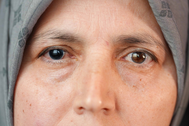 Banyoda düşen kadının hayatı altüst oldu! Kararan gözüne göz dövmesi ışık oldu - Resim: 1