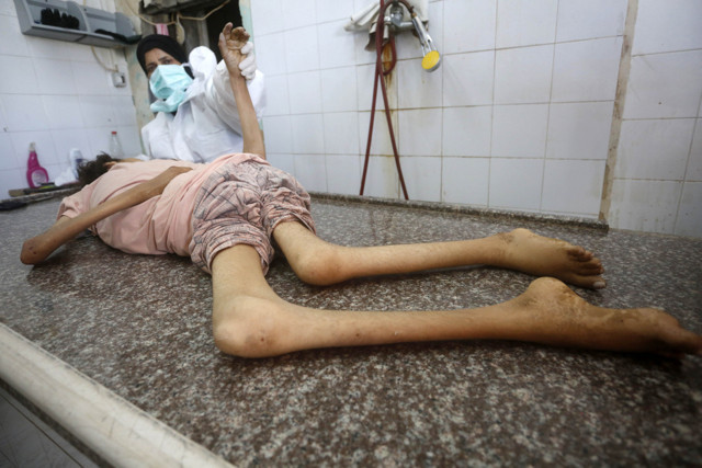 Gazze'de açlık nedeniyle ölümler sürüyor! Bir kız çocuğu hayatını kaybetti - Resim: 0