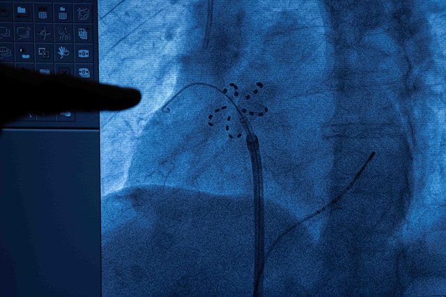 Kalpte ritim sorunlarına yeni çözüm - Resim: 1
