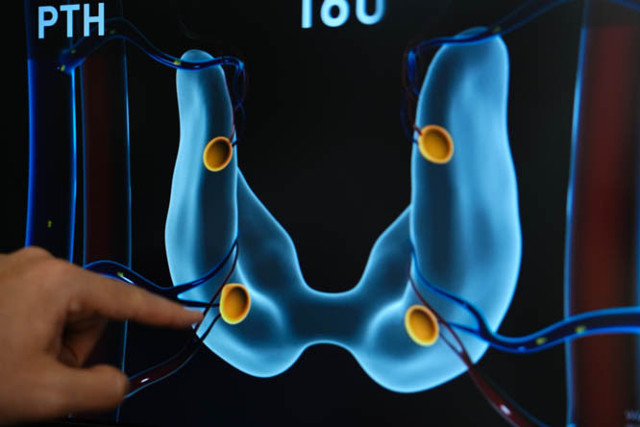 Sonbahar yorgunluğu sanmayın! Kalsiyum dengeniz bozulmuş olabilir - Resim: 0