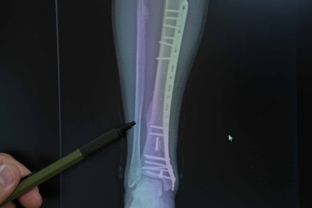 İki teker üzerindeki büyük tehlike! - Resim: 1