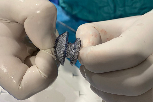 Çarpıntı, nefes darlığı ve yorgunluk varsa dikkat! Çocukluktan geliyor olabilir... - Resim: 0