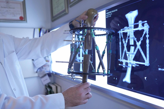 Boyun kısalığına karşı modern çözüm: Kemik uzatma yöntemleri - Resim: 0