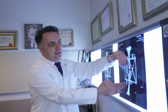 Boyun kısalığına karşı modern çözüm: Kemik uzatma yöntemleri - Resim: 1