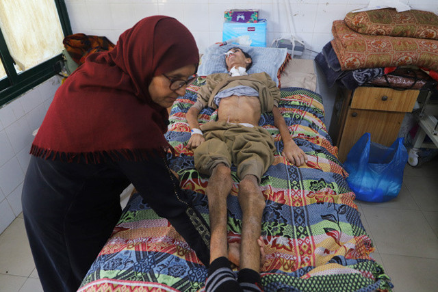 Gazze'de yardım kuyruğunda beklerken vuruldu felç kaldı - Resim: 1