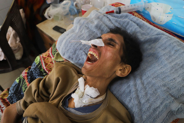 Gazze'de yardım kuyruğunda beklerken vuruldu felç kaldı - Resim: 0