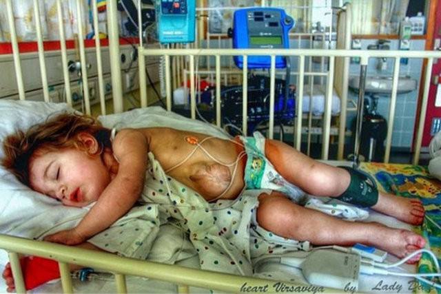 Mucize kız! Kalbi dışarıda atıyor - Resim: 1