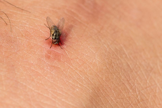 Sinek ısırığı hayatını kararttı - Resim: 4