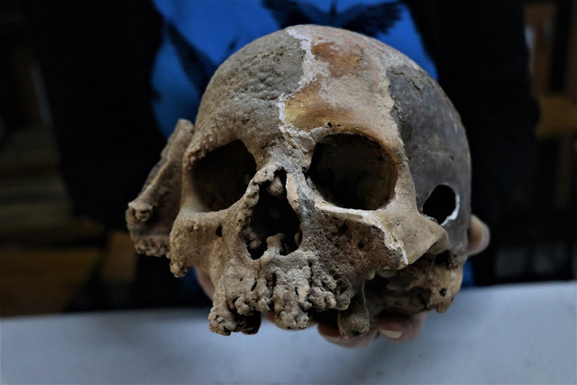 Daha önce benzerine rastlanmadı! Antalya'da bulundu - Resim: 3