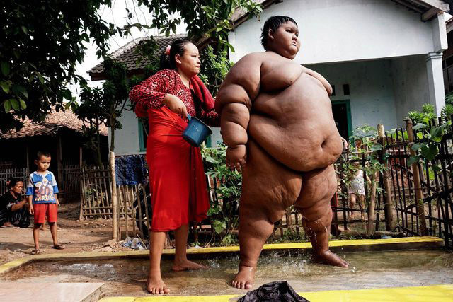 Dünyanın en şişman çocuğuydu! Son hali şaşırttı - Resim: 1