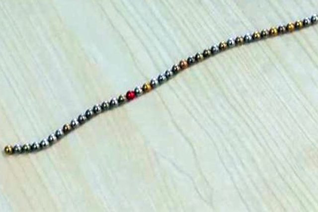 Penisinden çıkan şeyler şok etti! Tam 26 adet bakın nasıl içine girmiş - Resim: 2