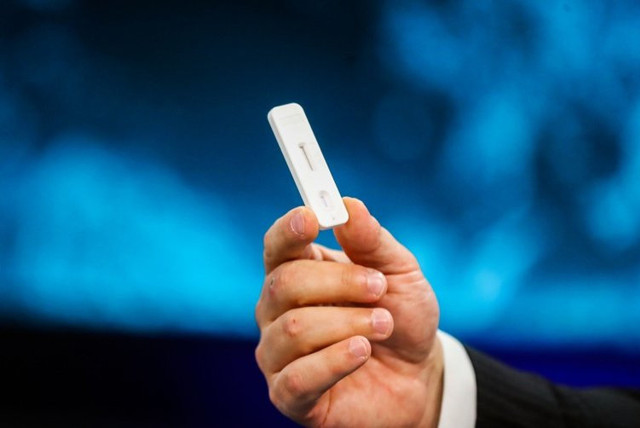 Mustafa Varank'tan yerli tanı kiti müjdesi: 30 dakikada sonuç alınıyor - Resim: 0