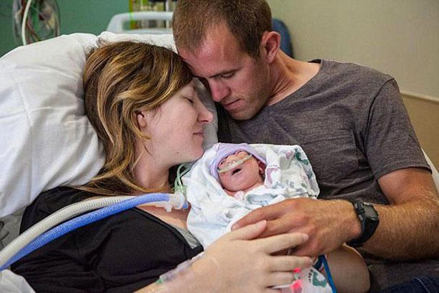 Bebeğinin öleceğini bile bile doğum yaptı bakın neden - Resim: 2