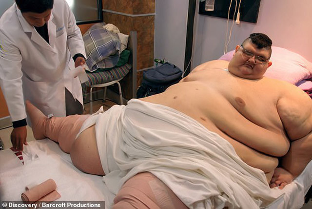 Tam 595 kiloydu! Bir de son haline bakın - Resim: 3