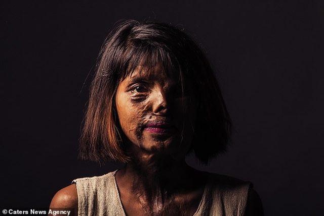 Annesi öldürüldü kendi asit saldırısına uğradı! Nedeni ise... - Resim: 2