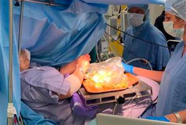 İnanılmaz! 60 yaşındaki kadın, beyin ameliyatı sırasında zeytin dolması yaptı - Resim: 0