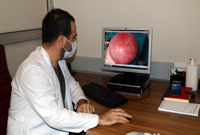 Van'da 18 yaşındaki gencin karnından çıktı! 9 kilo 800 gram ağırlığında kitle - Resim: 2