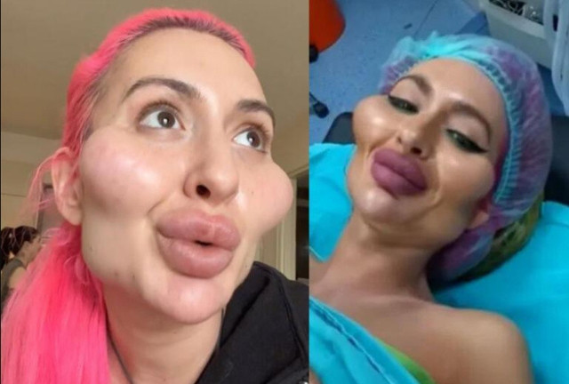 Doktorlar uyardı o vazgeçmiyor! Dünya'da tek olmak istiyor: Ameliyat için yeniden Türkiye'ye geldi! - Resim: 0