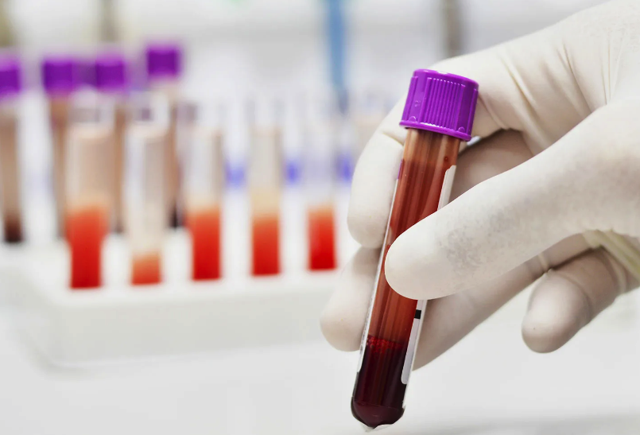 A Rh+ kan gurubuna sahip olanlar dikkat! Yorgunluğun çaresi belli oldu - Resim: 1