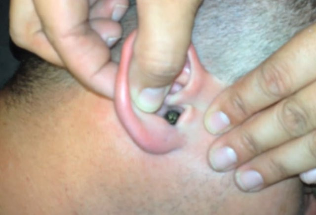 Bir anda yere yığıldı kulağından çıkana bakın - Resim: 4