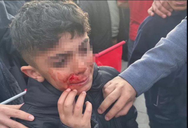 Ekrem İmamoğlu'ndan saldırı açıklaması! Fotoğrafı gösterdi: 'Şu çocuğu polis koruyamadı' - Resim: 0