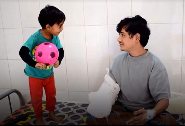 Ağaç adam Abul Bajander bakın nasıl iyileşiyor! - Resim: 4