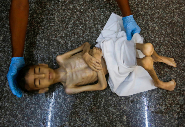 İnsanlıktan utandıran görüntüler! Gazzeli Hikmet, yetersiz beslenme nedeniyle öldü - Resim: 1