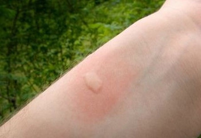 Tırnağınıza sürün bakın ne oluyor! - Resim: 1