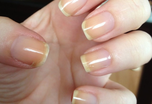 Tırnağınıza sürün bakın ne oluyor! - Resim: 2