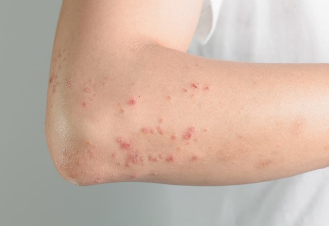 Bu belirtiler varsa dikkat! - Resim: 3