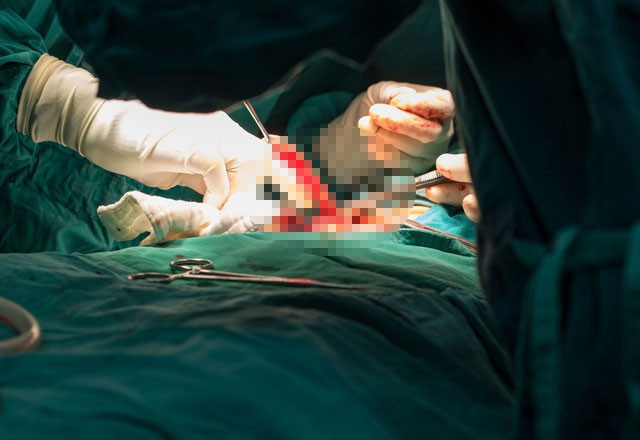 Yumurtalıklarından beyin ve saç çıktı inanılmaz olay! - Resim: 2