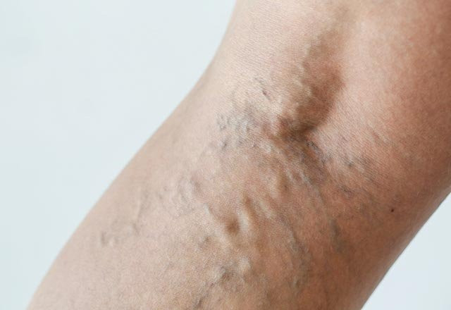 Koksa da çiğ olarak tüketin - Resim: 1