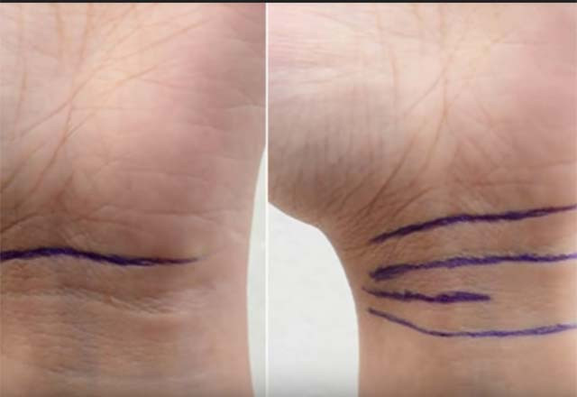 Bileğinizdeki çizgilerin anlamı ne? - Resim: 1