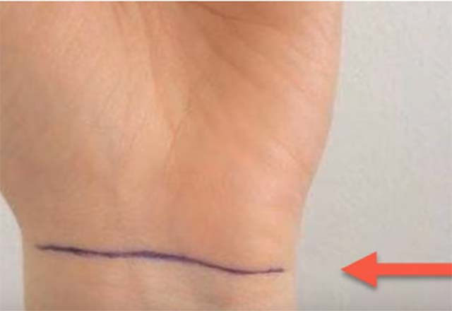 Bileğinizdeki çizgilerin anlamı ne? - Resim: 2