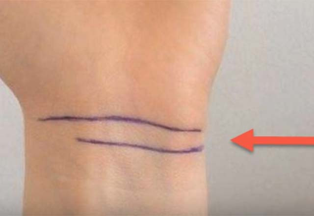 Bileğinizdeki çizgilerin anlamı ne? - Resim: 3