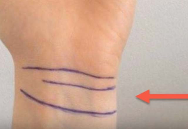 Bileğinizdeki çizgilerin anlamı ne? - Resim: 4