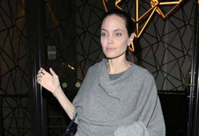 Aşırı zayıflığının nedeni belli oldu - Resim: 3