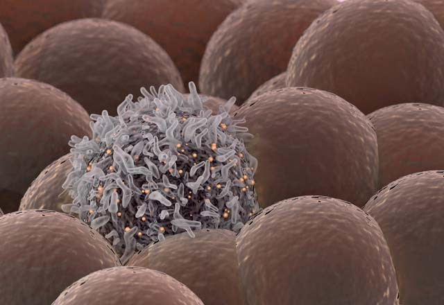 Köpek balığı kıkırdağı bu hastalıklara çare mi? - Resim: 2