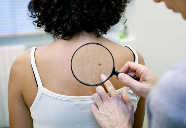 Köpek balığı kıkırdağı bu hastalıklara çare mi? - Resim: 3