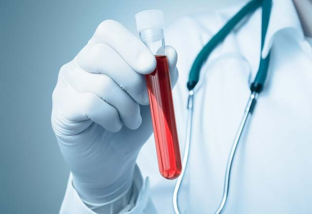 Köpek balığı kıkırdağı bu hastalıklara çare mi? - Resim: 4