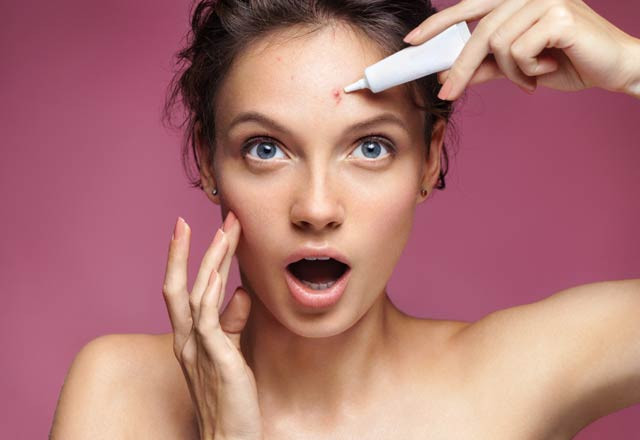 Çenenizde sivilce çıkıyorsa dikkat! - Resim: 2