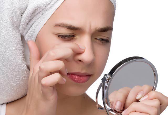 Çenenizde sivilce çıkıyorsa dikkat! - Resim: 3