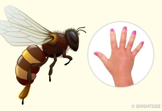 Bu böcek ısırıklarına dikkat! Hangileri tehlikeli - Resim: 2